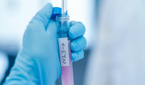 User Manual for Measuring Parkinson's Protein Could Speed Research