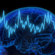 Podcast: Refining Deep Brain Stimulation