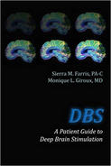 Book cover for "DBS: A Patient Guide to Deep Brain Stimulation."
