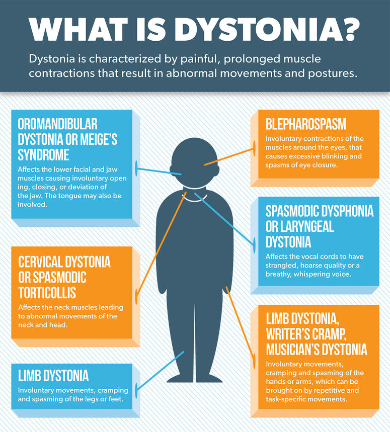 Dystonia Parkinson S Disease   Dystonia Infographic 1628 