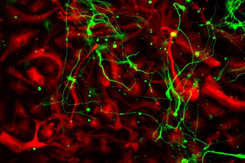 Differentiated neural stem cells