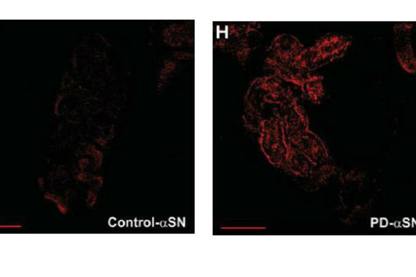 Who’s to Blame? Finding Toxic Alpha-synuclein