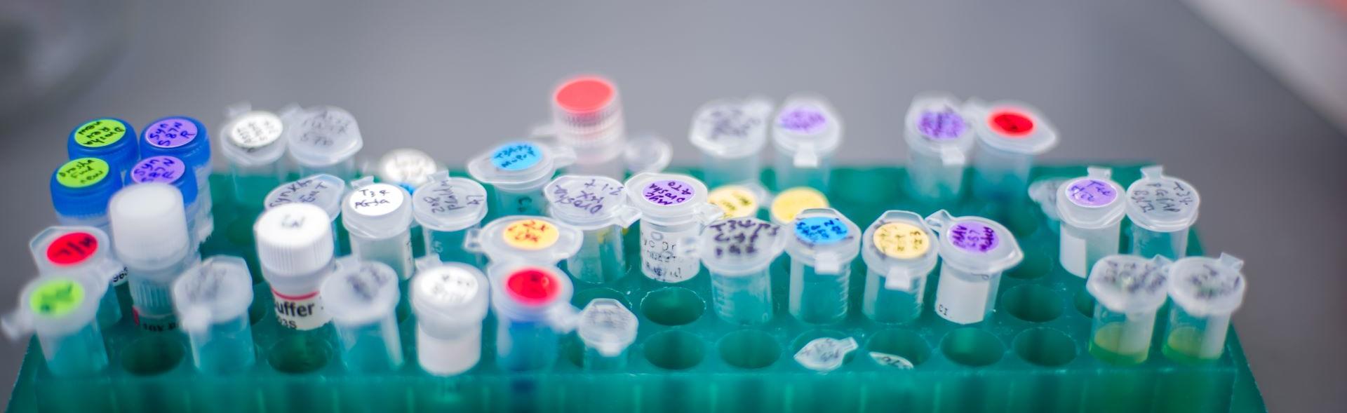 Test tubes in a research lab.